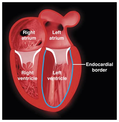 lv function heart|left ventricle heart diagram.